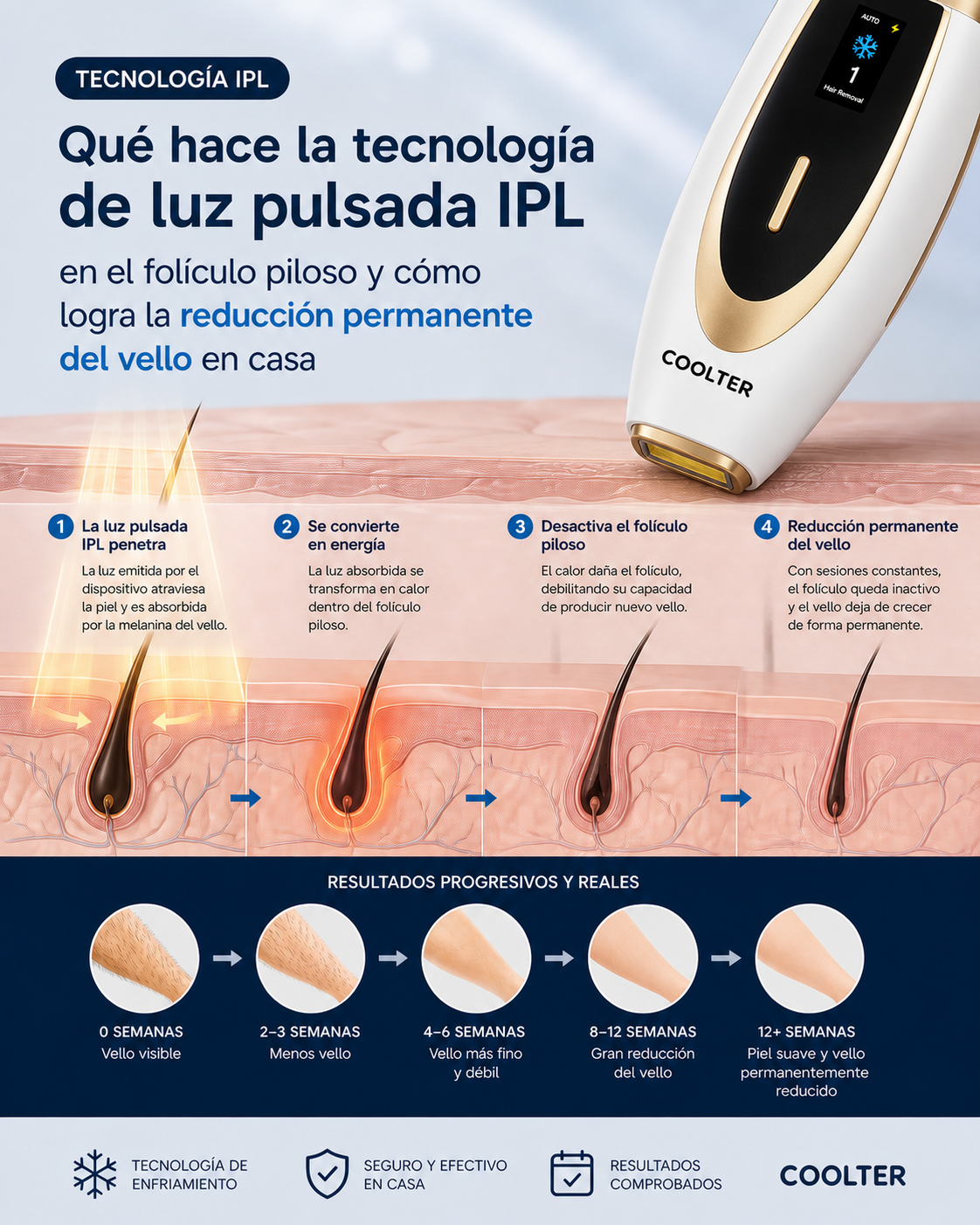 Qué hace la tecnología IPL en el folículo piloso y cómo reduce el vello ...